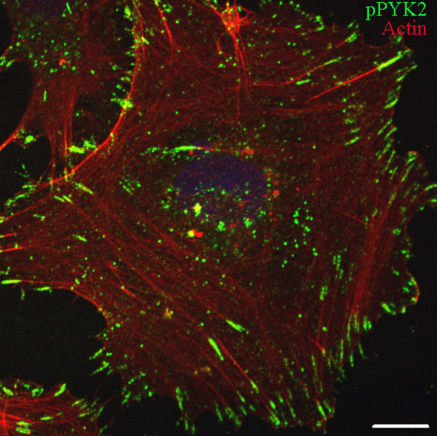 Sima Lev: pPYK2 picture
